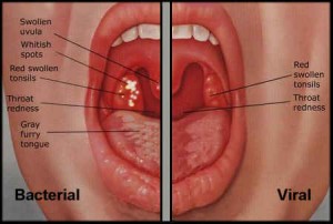 will cipro cover strep throat